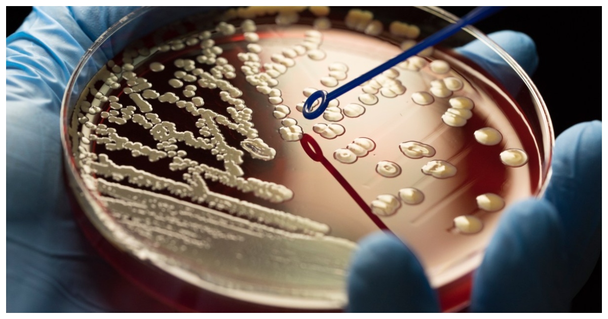 অ্যামেরিকায়ও ক্রমেই বাড়ছে সুপারবাগ সংক্রমণ। ছবি: দ্য টাইমস